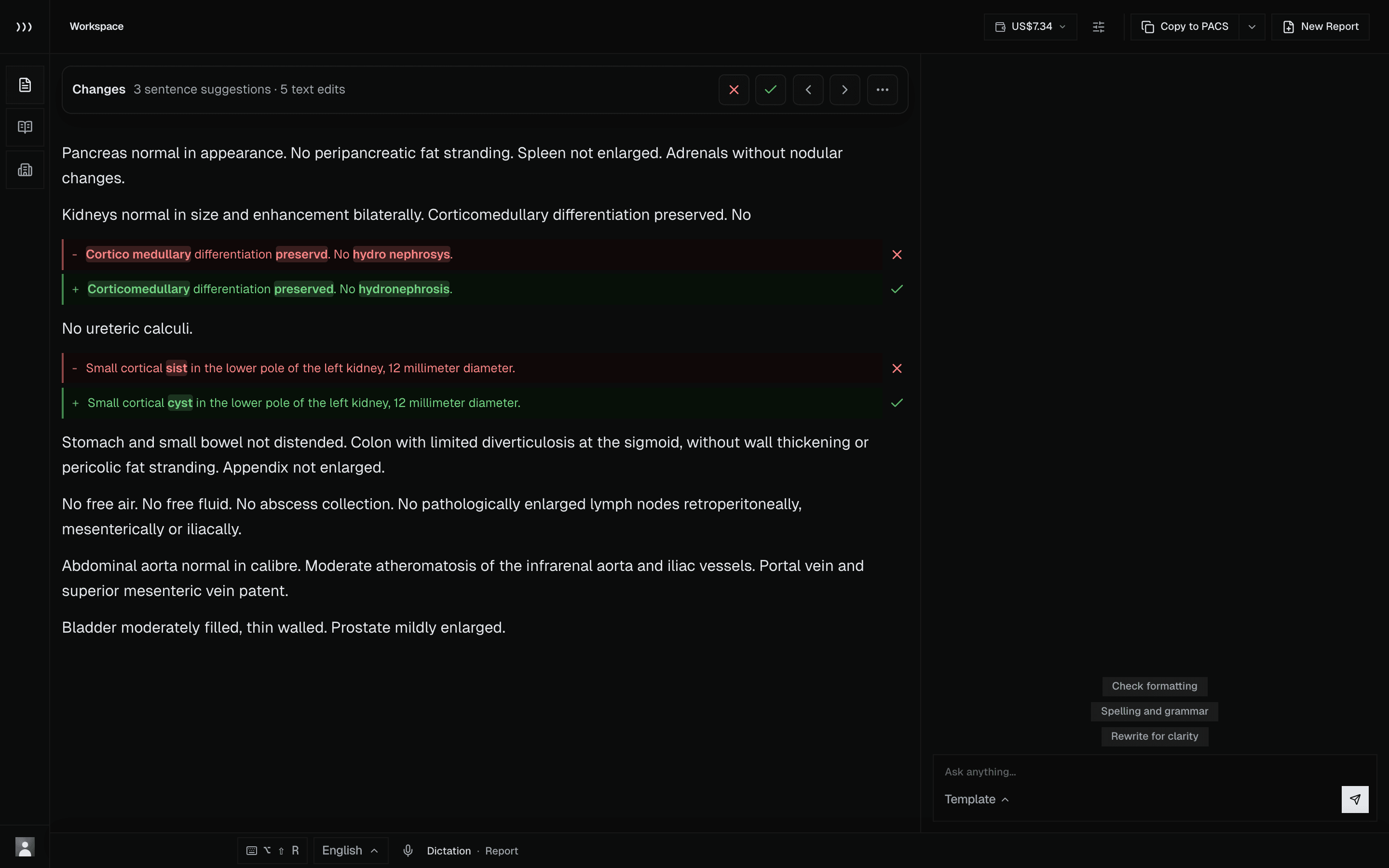 Revelar workspace interface