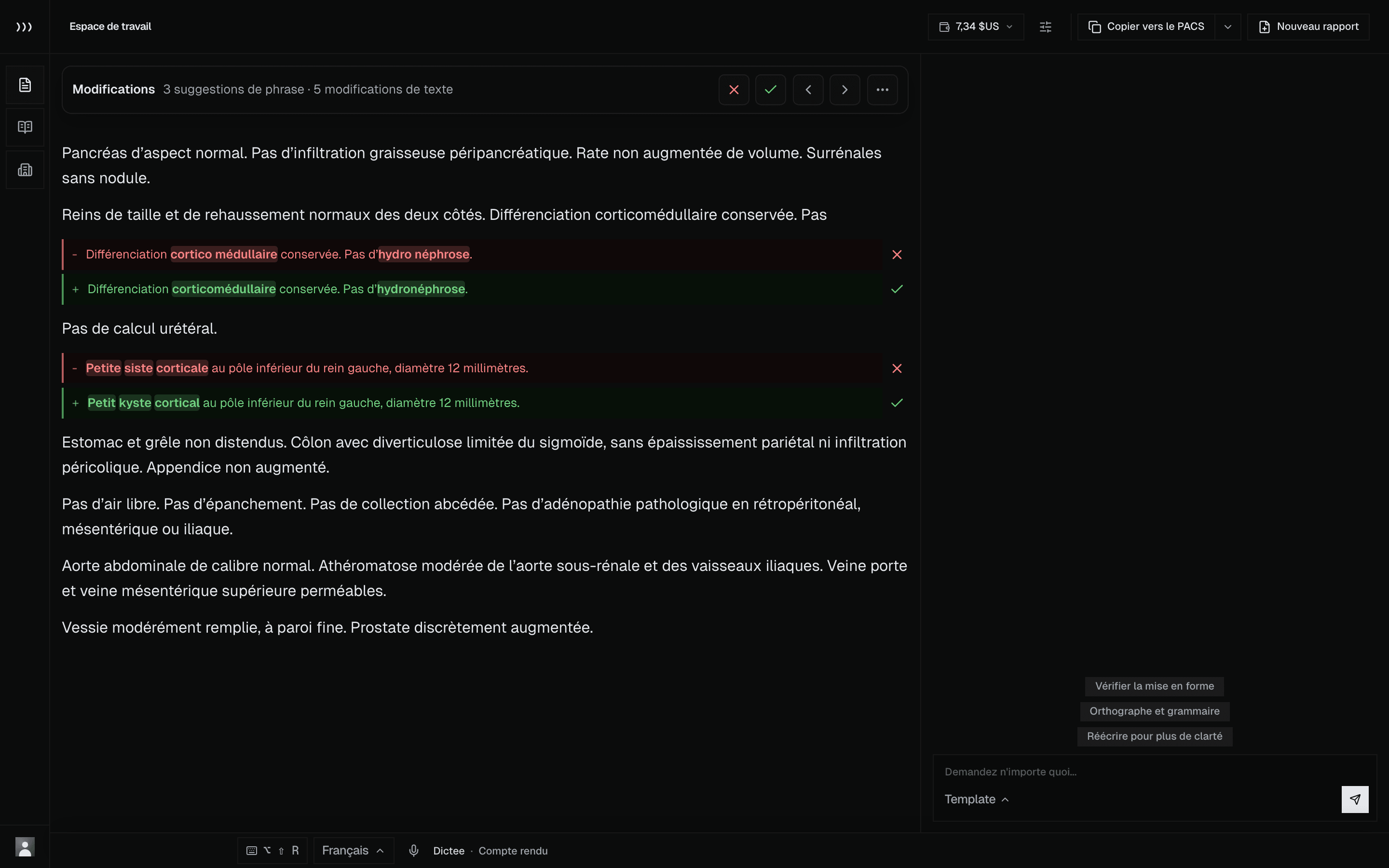 Interface de l'espace de travail Revelar